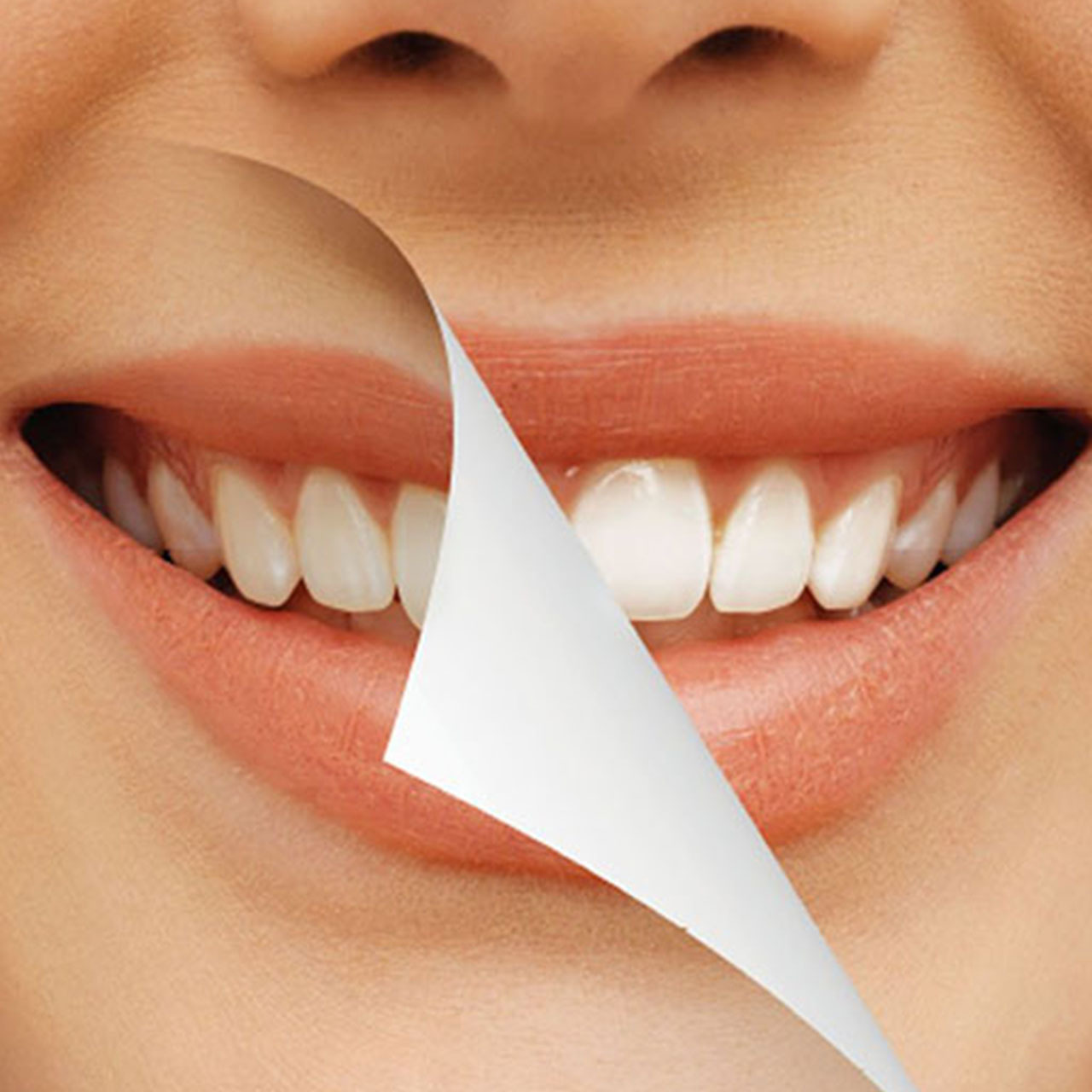 Dentrip web -- The Benefits of Teeth Whitening