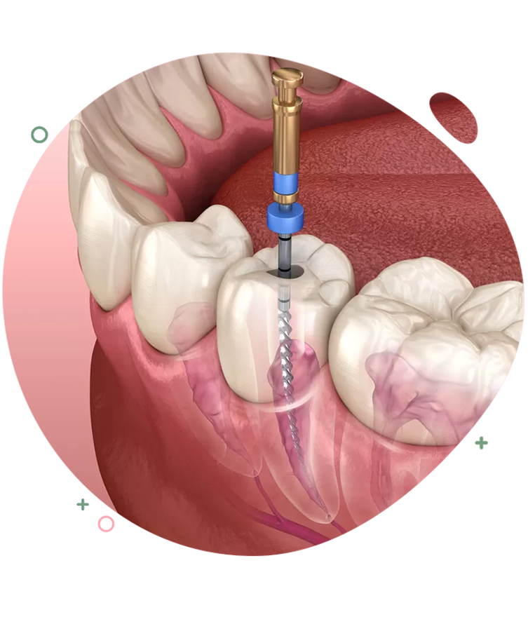 https://dentripalbania.com/wp-content/uploads/2023/05/Dentrip-web-Services-Advantages-of-dental-implants.png