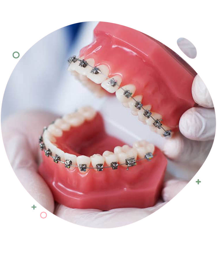 https://dentripalbania.com/wp-content/uploads/2023/05/Dentrip-web-Services-Invisalign-orthodontics.png