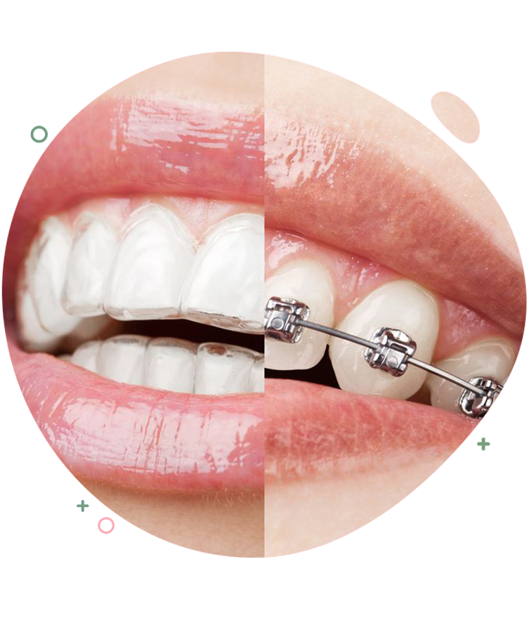 https://dentripalbania.com/wp-content/uploads/2023/05/Dentrip-web-Services-The-4-benefits-of-the-revolutionary-Invisalign-technology.png