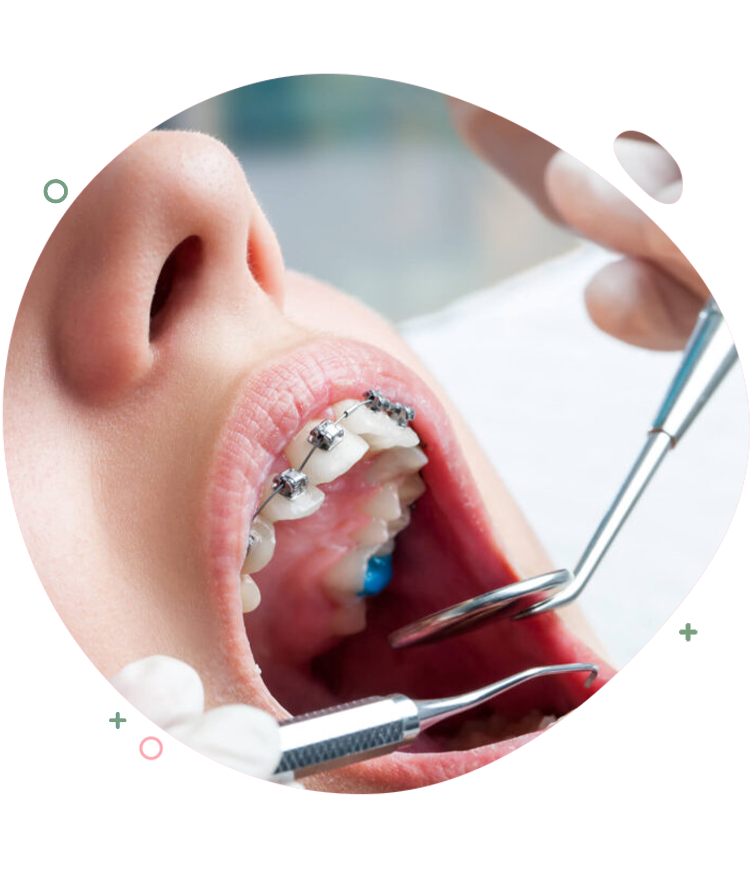 https://dentripalbania.com/wp-content/uploads/2023/05/Dentrip-web-Services-orthodontics-how-it-works.png